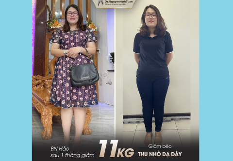 Rũ bỏ 11kg sau 1 tháng thực hiện nội soi thu nhỏ dạ dày